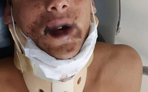 Un rugbier golpeó salvajemente a un chico en un bar: «lo golpeaba hasta cuando ya estaba desmayado»