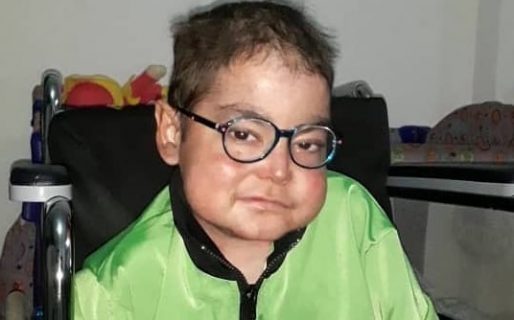 Tiene piel de mariposa, condición que le produjo una sordera total, y su sueño es volver a escuchar