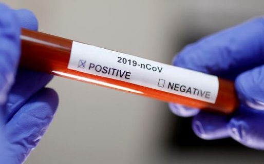 Los casos de Covid-19 se duplicaron de ayer a hoy, y hubo dos fallecidos en Comodoro