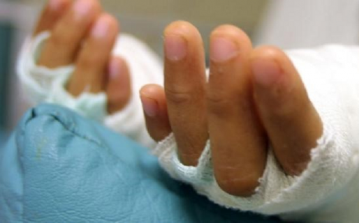 Una mujer fue rociada con nafta en el rostro y luego prendida fuego