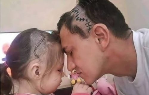 Se cortó el pelo para imitar la cicatriz que le quedó a su hija en la cabeza tras una cirugía