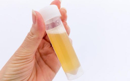 Orina con espuma: qué significa y por qué hay que estar alerta