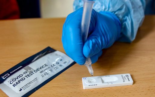 Se robaron 70.000 test de coronavirus y la ANMAT prohibió su uso para evitar que se comercialicen