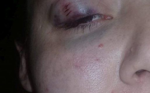 Su novio la golpeó hasta dejarla inconsciente y después la denunció a ella