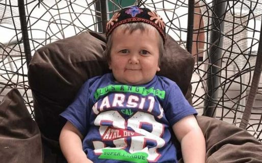 Tiene 18 años pero una enfermedad lo hace poseer la apariencia de un niño