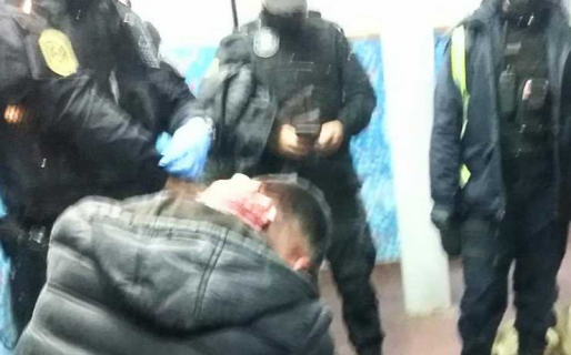 Le dieron un machetazo en la nuca ocasionándole un corte, pero no quiso denunciar a su agresor