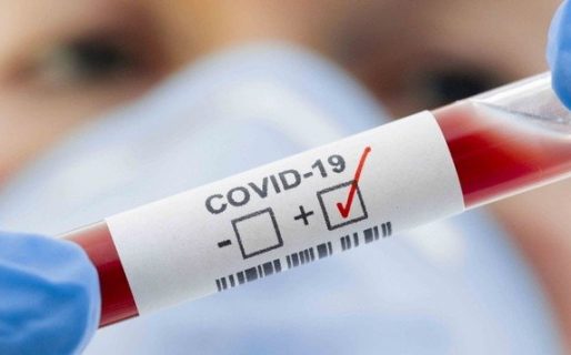 Coronavirus en Argentina:  4.647 casos y otros 71 muertos en las últimas 24 horas