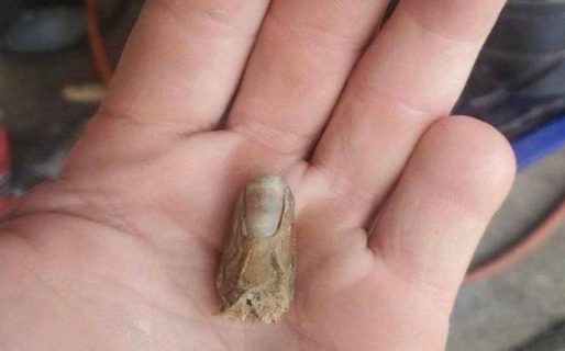 Se cortó un dedo y lo encontró seis meses después