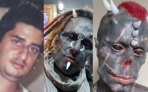 El antes y después de “El demonio humano”, el hombre que se implantó cuernos y se modificó la nariz