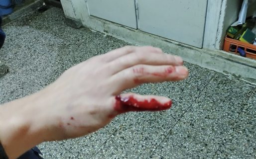 Los detuvieron robando en una rotisería con un corte en la mano