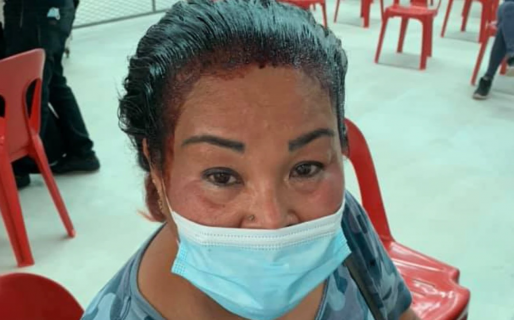 Tenía turno para vacunarse cuando se estaba tiñendo el pelo, pero fue igual