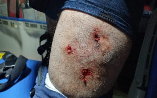 Persiguió a un ladrón y fue atacado por un perro