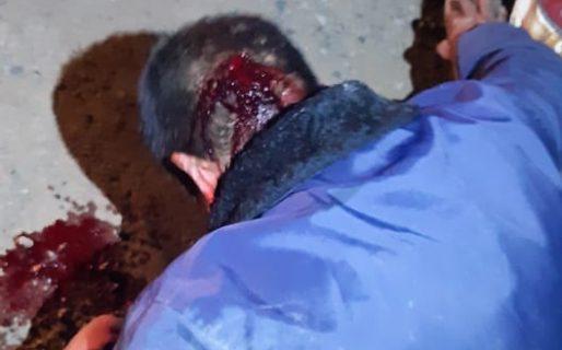 Le rompió la cabeza a un agente de un piedrazo