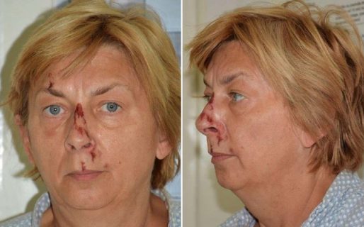 Una mujer fue hallada en una isla con heridas y amnesia en Croacia