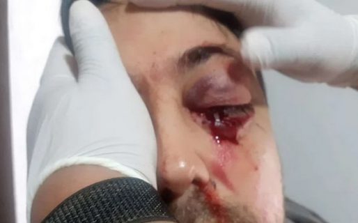 Brutal pelea de padres en la puerta de un colegio de Caseros: uno perdió un ojo