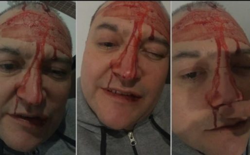 Leo García denunció una brutal agresión y publicó impactantes videos: “Me pegaron por ser homosexual”