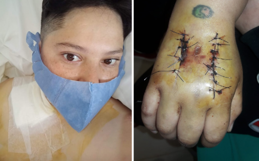 Sufrió un accidente laboral, lo despidieron en plena pandemia y vende sorrentinos para salir adelante