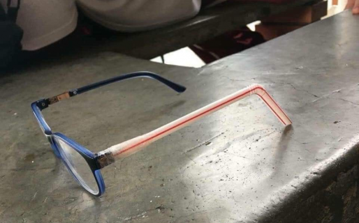 La ingeniosa e insólita manera de arreglar unos lentes rotos