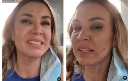 Dallys Ferreira sufrió un violento ataque en la calle y debió ir al hospital: “En mi vida me humillaron tanto”