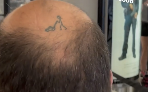 Se quedaba calvo y tuvo una idea brillante