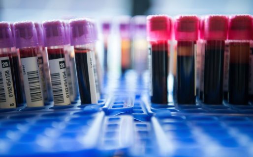 Solo con una gota de sangre: un test permite la detección temprana de 50 tipos de cáncer