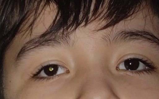 Tiene 12 años, padece una enfermedad poco frecuente y piden colaboración para solventar los gastos médicos