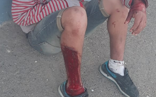 Se juntó a beber con personas que no conocía en el Pietrobelli: le robaron todo y lo apuñalaron