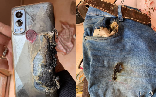 Le explotó el celular en el bolsillo y sufrió graves quemaduras