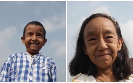 La historia de «los hermanos Benjamin Button»: dos nenes que aparentan tener 80 a causa de una rara enfermedad