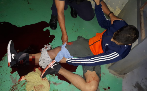 Interno de la alcaidía sufrió una impresionante lesión en un confuso episodio