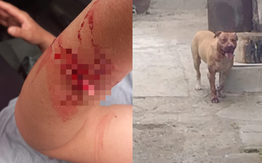 Un pitbull suelto atacó, hirió a una mujer y dejó agonizando a otra perra