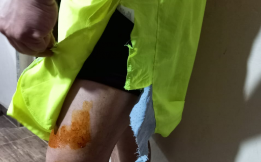 Fue atacado por un San Bernardo al que paseaban sin correa