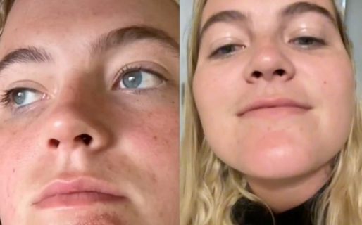 Sufrió una grave y extraña infección tras besar a un hombre con barba