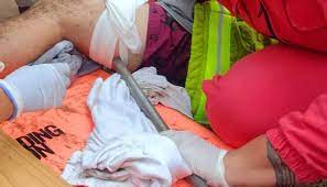 El viento voló una sombrilla y se la clavó en la pierna del dueño: terminó hospitalizado