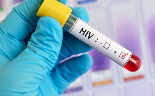 Comienzan a probar en humanos una vacuna contra el VIH