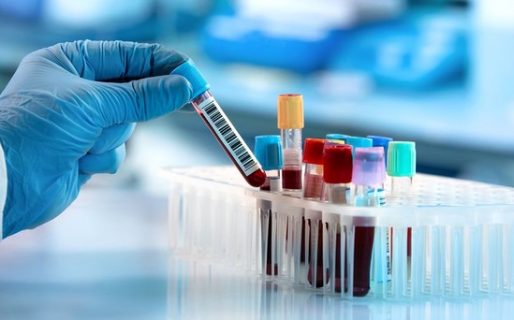 Cómo sé si tuve Covid y qué test debo hacerme para averiguarlo