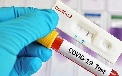 En Chubut las farmacias no tienen a la venta los test rápidos