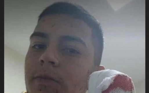 Le cortaron cuatro dedos con un machete a un joven delivery para robarle la moto