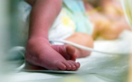 Un bebé nació con dos cabezas, tres manos y dos corazones: no lo quieren operar y esperan un milagro