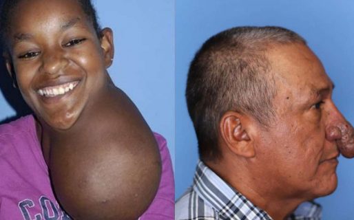 Las cirugías del doctor Milagro: construyó una oreja de cero y extirpó deformidades