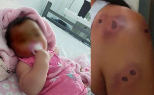 Una beba de 5 meses recibió un balazo de goma en la cabeza durante un procedimiento policial