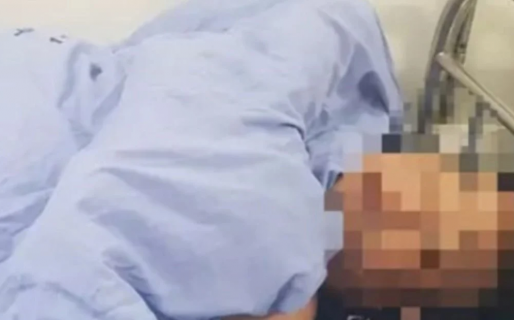 Le cortó el pene a su pareja después de atraparlo abusando de su hija