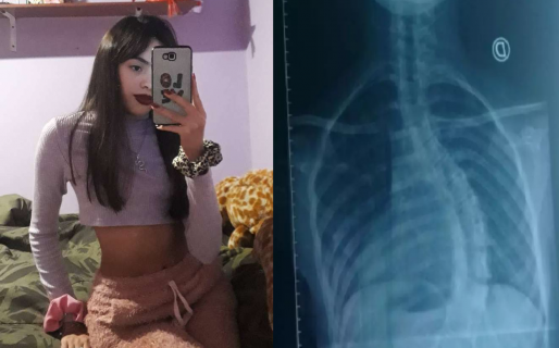 Tiene escoliosis, iba a operarse y su papá se quedó sin trabajo: necesita más de un millón de pesos