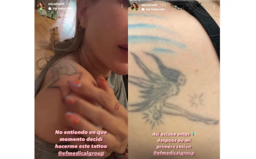 Mica Tinelli empezó a borrarse los tatuajes: “No entiendo en qué momento decidí hacerme esto”