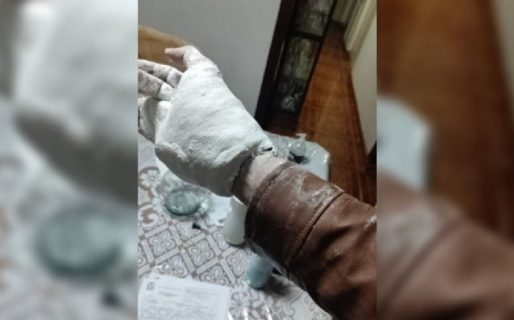 El drama del joven enyesado que no se puede sacar la campera