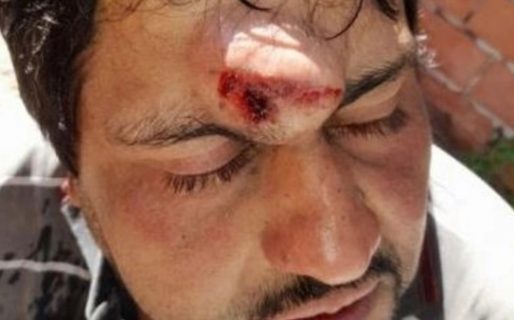 Vendedores ambulantes le partieron un adoquín en la cabeza a un hombre que no quiso comprarles medias