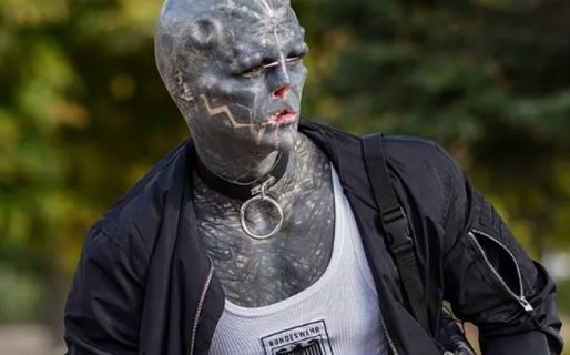 Quiere parecer un alien y ahora se amputará una pierna