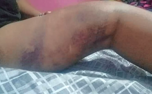 Denuncian brutal agresión tras un choque de autos en el barrio San Martín