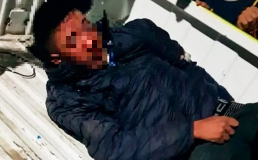 Brutal linchamiento: vecinos atraparon a un motochorro y le cortaron dos dedos