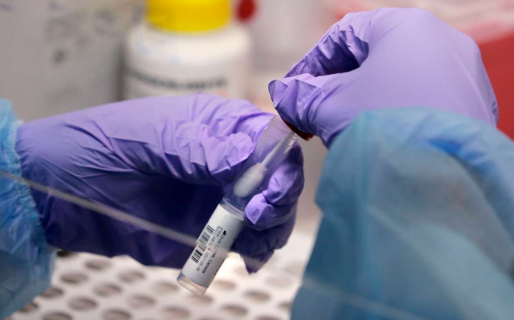 Por las trabas a la importación, advierten que faltarán reactivos para diagnosticar enfermedades